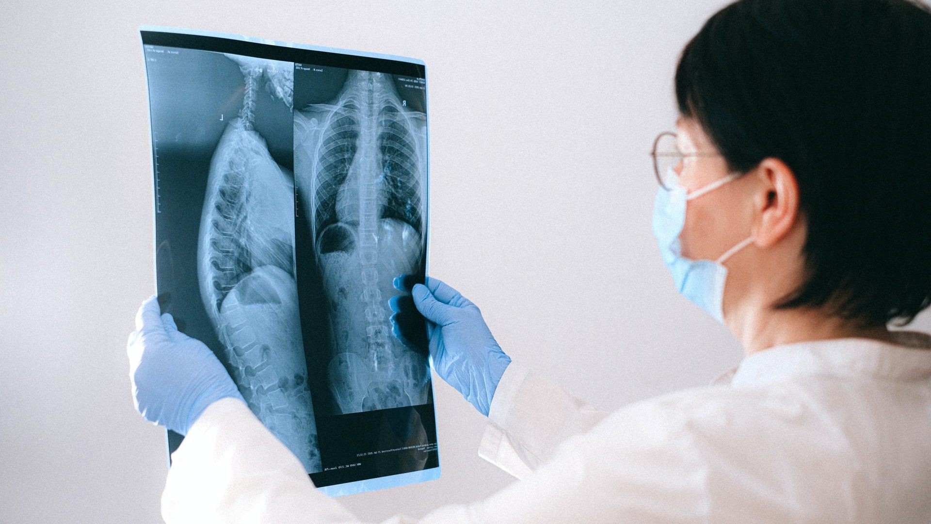 Eine Ärztin mit Maske hält ein Röntgenbild einer Wirbelsäule in ihren Händen