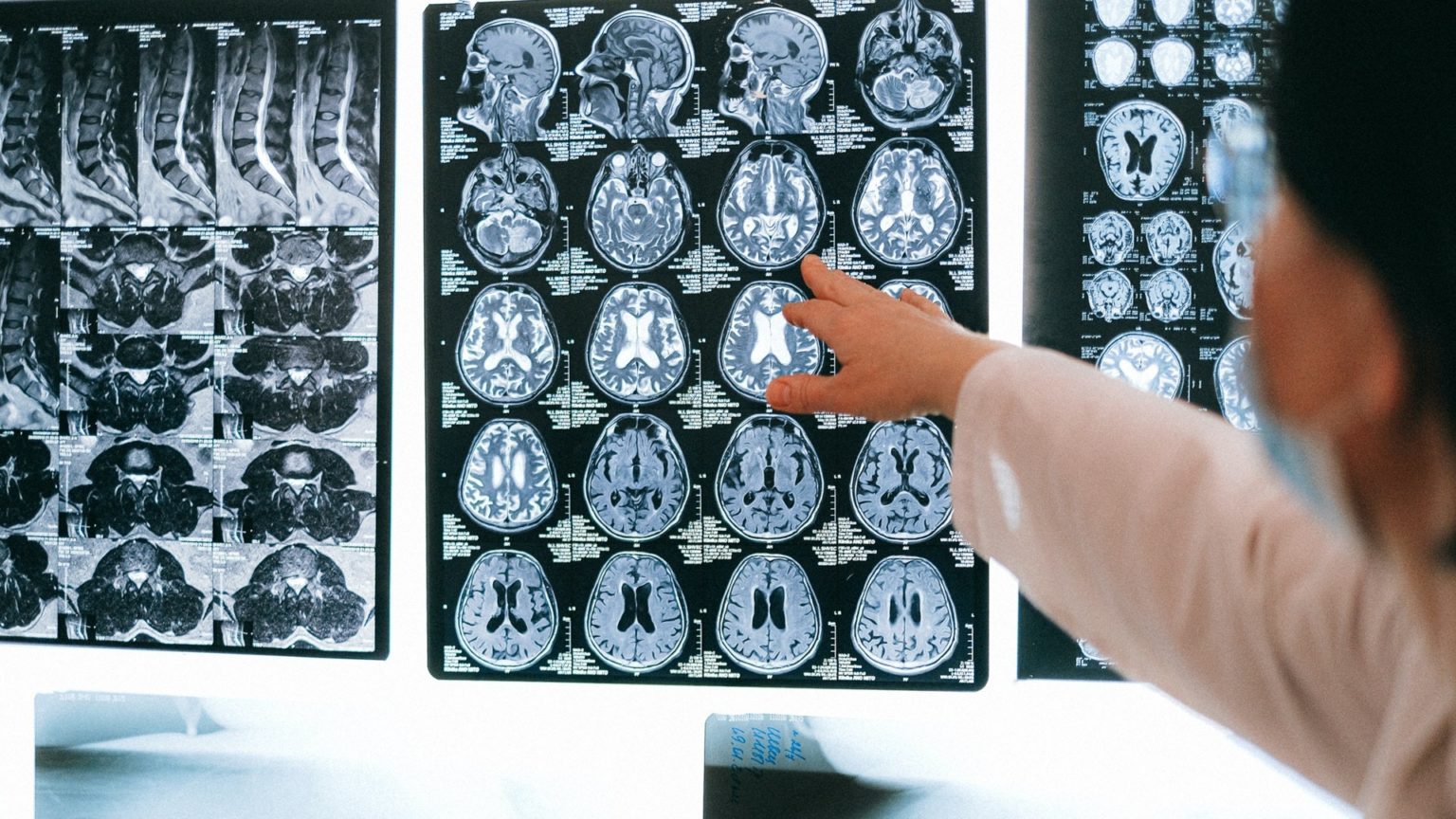 Eine Ärztin mit Maske deutet auf Magnetic Resonance Imaging (MRI)-Bilder eines Gehirns